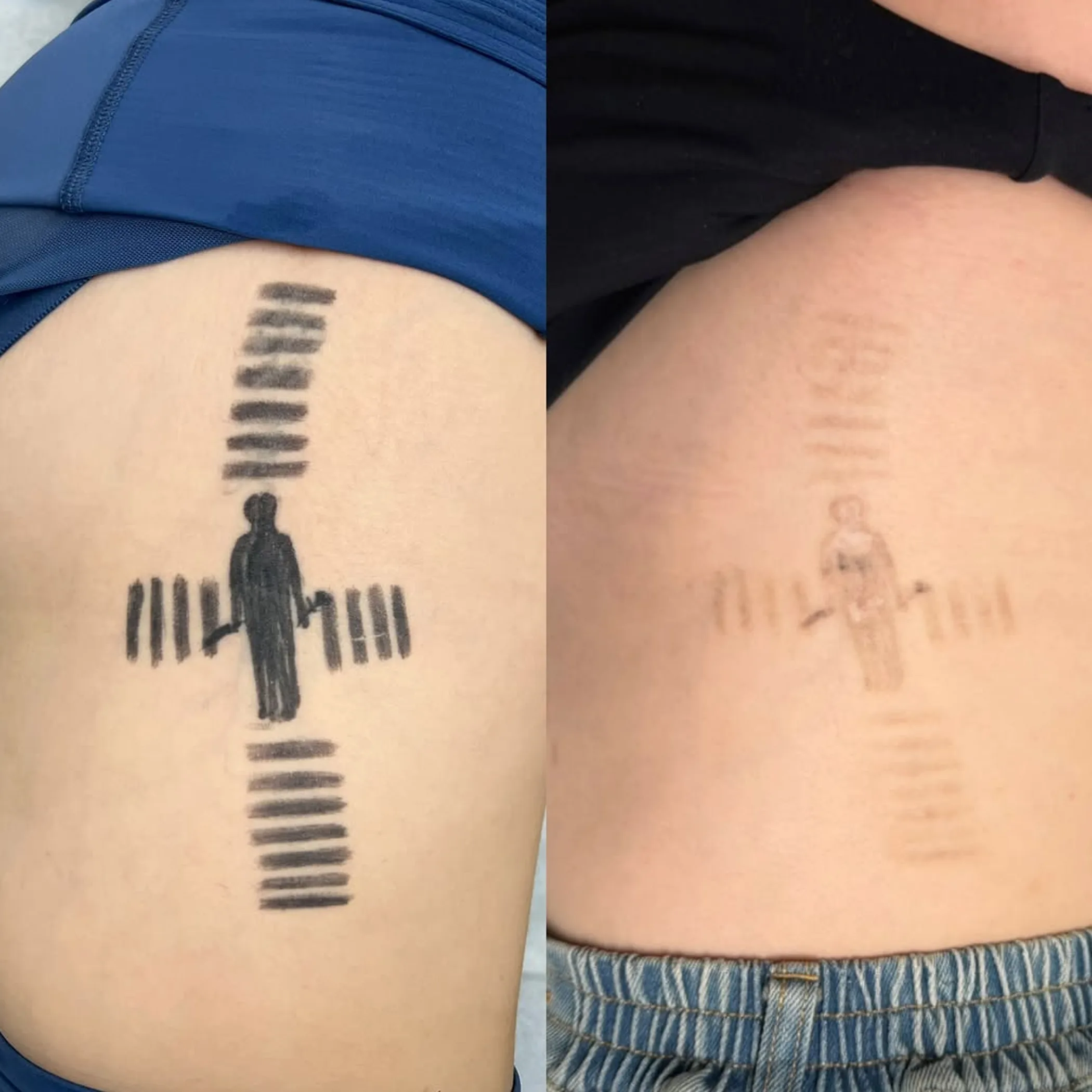 aftercare ointment being lightly spread on skin