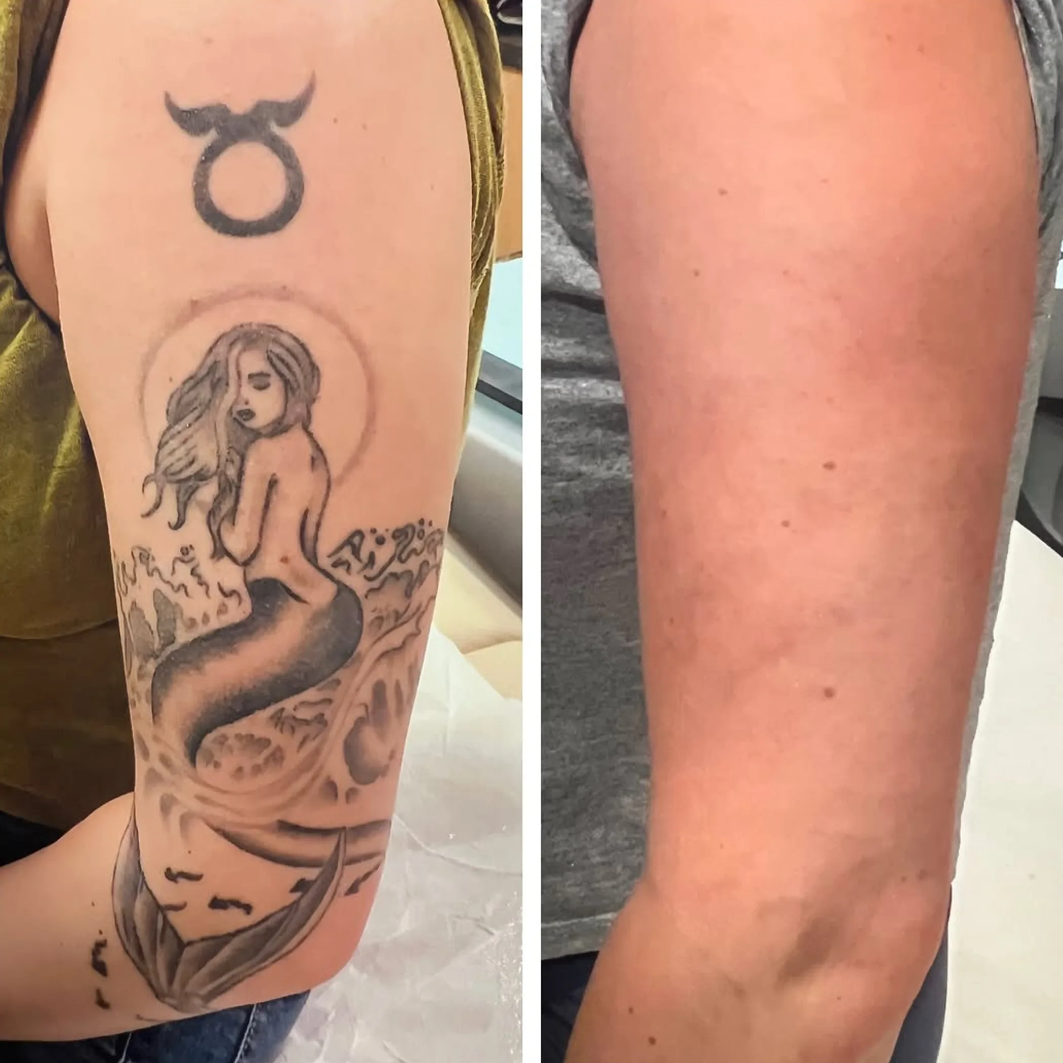 person wearing loose cotton sleeve over healing tattoo