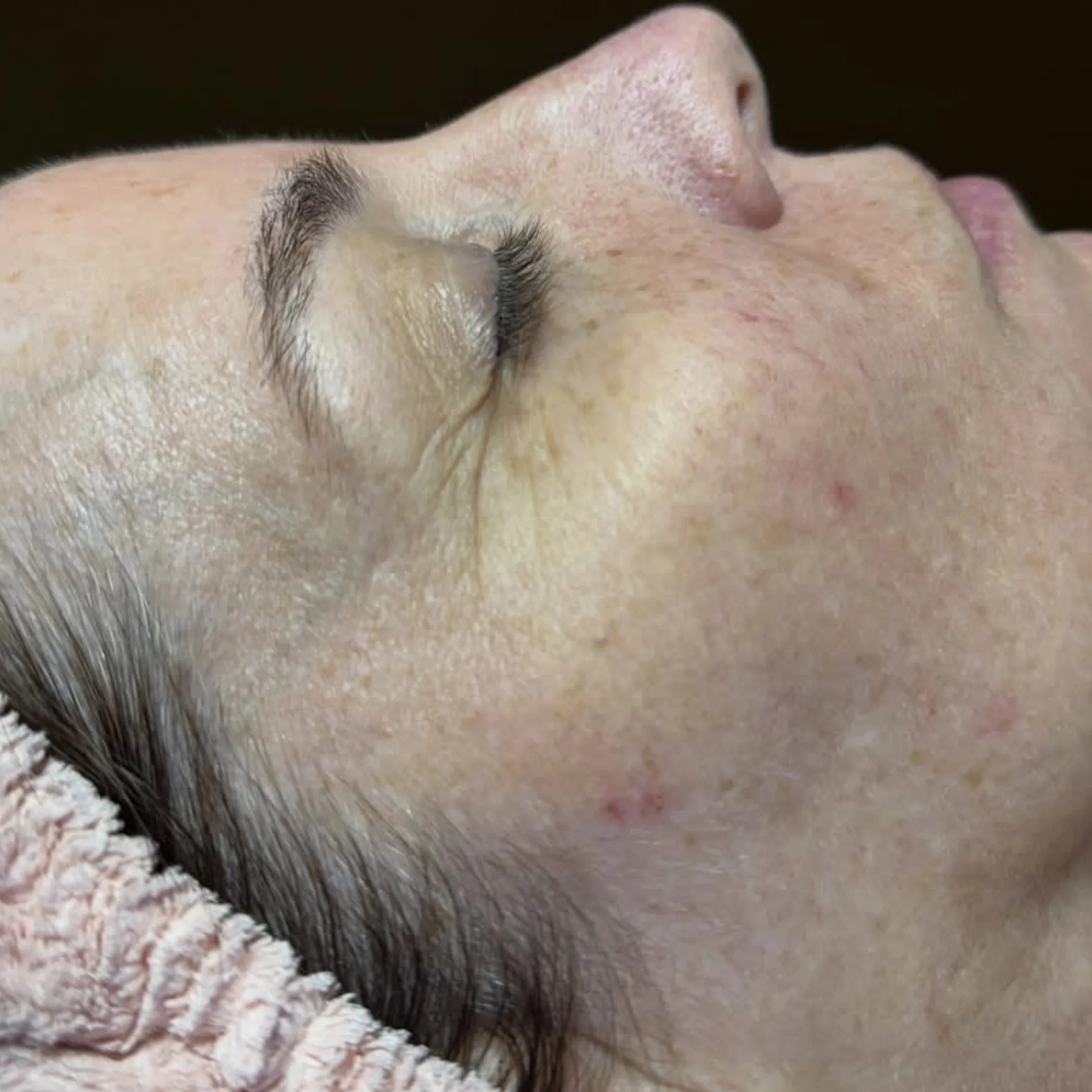clean, well-lit facial skin