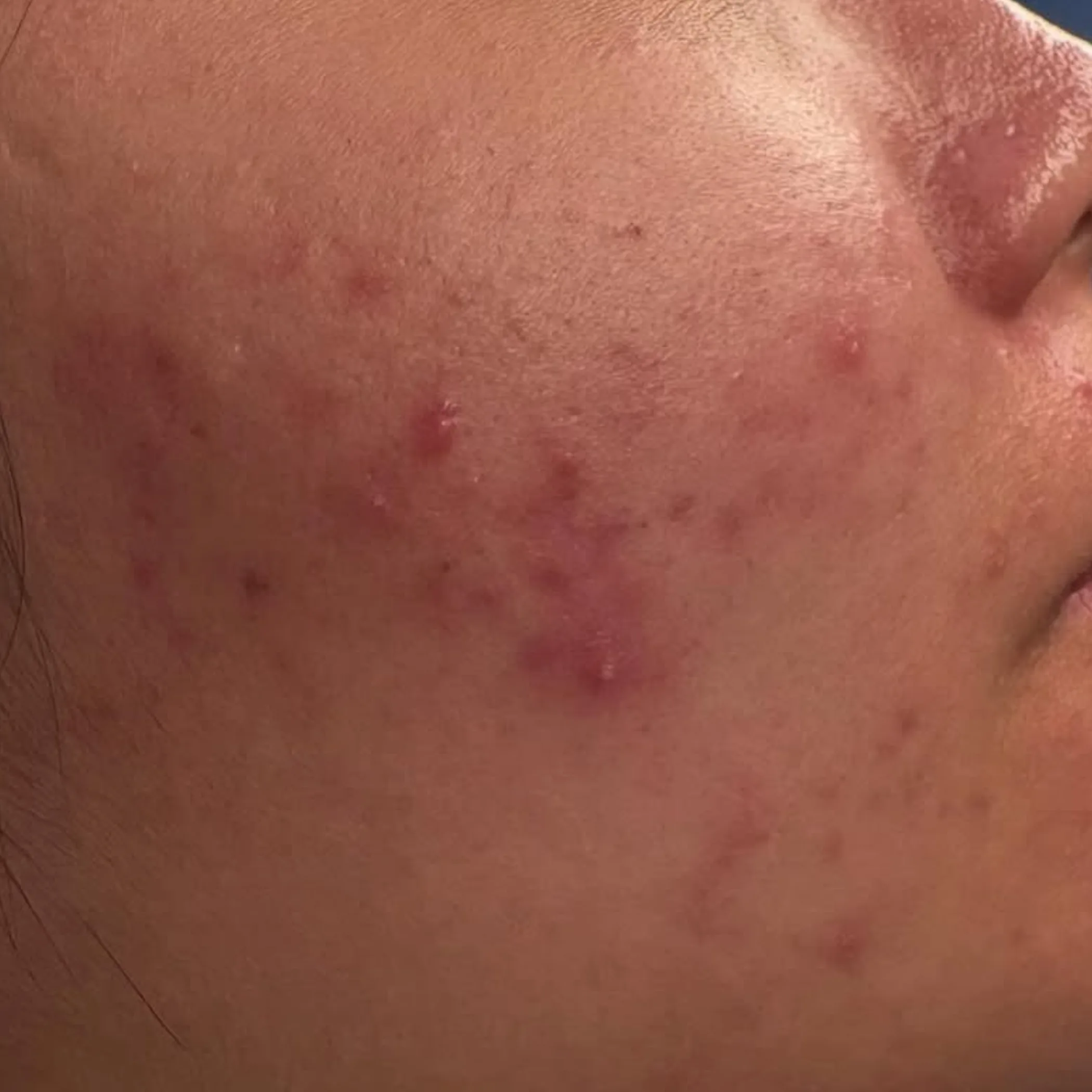 clear facial skin close-up